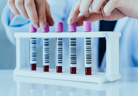 DRUG DEVELOPMENT CYCLE  Pre-clinical